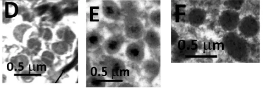 Figure 4 – Electron microscopy images (D) of the large homogeneous granules that are located in  the central area of the disc, (E) the smaller and more complex granules located in all the rest of the central  area, (F) and the small, membrane-bound ellipti
