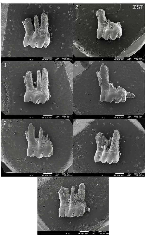 Figura 10 – Visão corono-radicular em MEV dos primeiros molares inferiores esquerdos extraídos do  grupo ZST