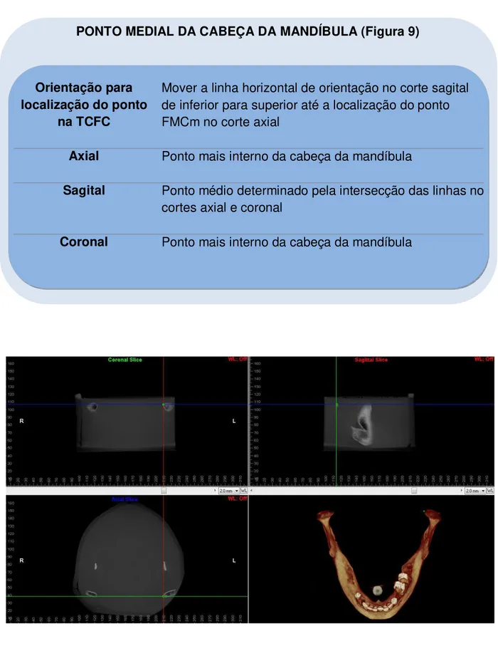 Figura 9 – Identificação do ponto medial da cabeça da mandíbula. 