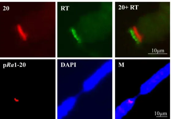 Figure  6:  (1.9,  RT,  M)  Simultaneous  detection  of  the  pRa1-20  probe  hybridization  (20)  and  telomeric reverse transcriptase (RT) at the polytene chromosome