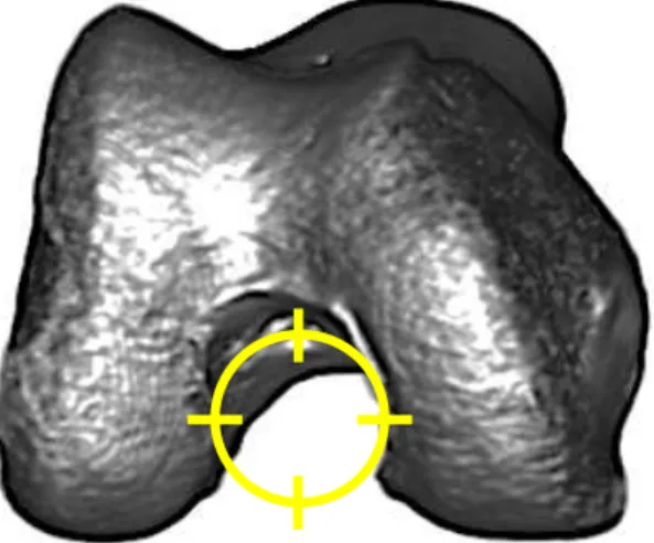 FIGURA  10.  Representação  do  modelo  do  “relógio”  em  reconstrução  tomográfica do intercôndilo do fêmur