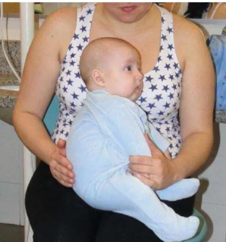 Figura 1  – Posicionamento da criança no colo do responsável, para a moldagem 