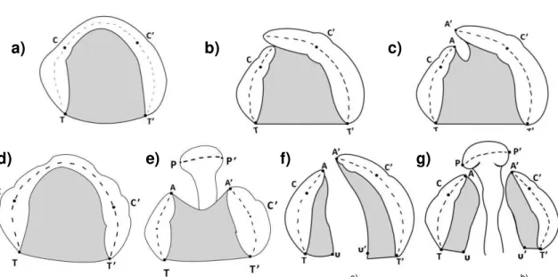 Figura 7  –   Pontos de referência utilizados com as crianças  a)  sem fissura; com fissuras   b)  pré- pré-forame  unilateral  incompleta;  c)   pré-forame  unilateral  completa;  d)   pré-forame  bilateral  incompleta;  e)   pré-forame  bilateral  comple