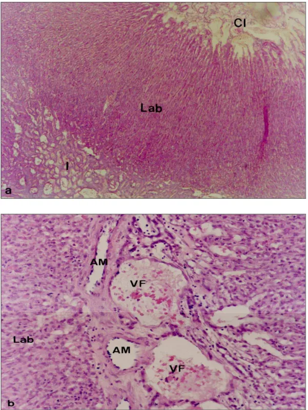 Fig. 6:  Lóbulo placentário.  (a)  Vista  panorâmica  do  lóbulo  placentário  evidenciando  o  seu               centro  (Cl), o labirinto (Lab) e o interlóbulo (I)