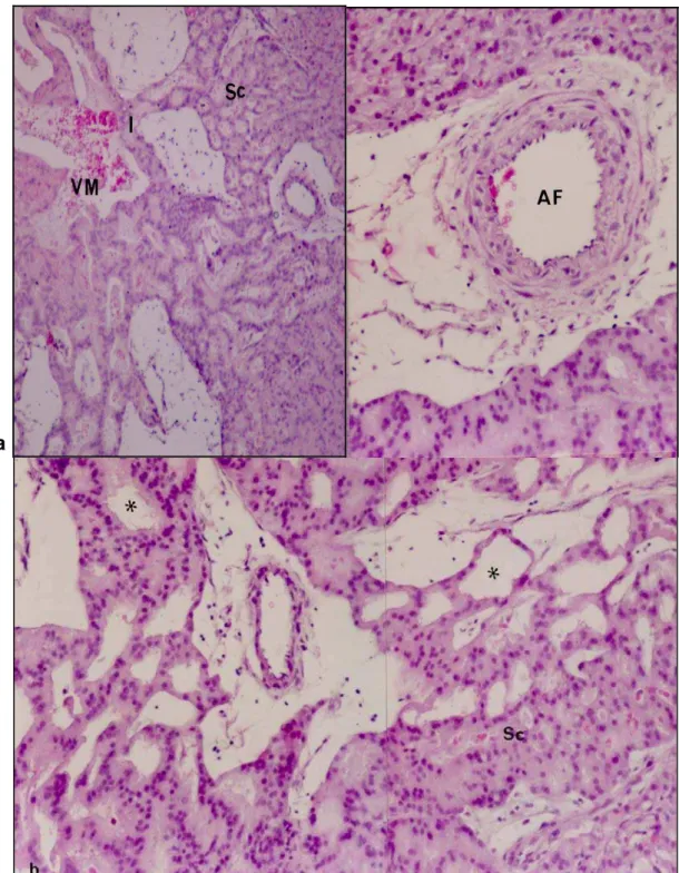 Fig. 7:  Interlóbulo.  (a)  Em pequeno aumento, na região interlobular (I)  pode-se  observar                 além do aspecto trabeculado do sinciciotrofoblasto (Sc);  a  formação  de  grandes  veias                     maternas  (VM)
