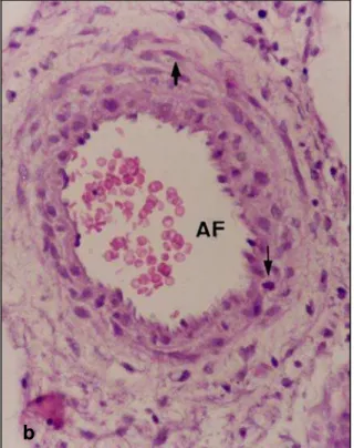Fig. 10: Interlóbulo.  (a) Observar a ramificação das artérias fetais (AF)  na  periferia  do                      lóbulo, emitindo capilares ao adentrarem o labirinto (Lab)