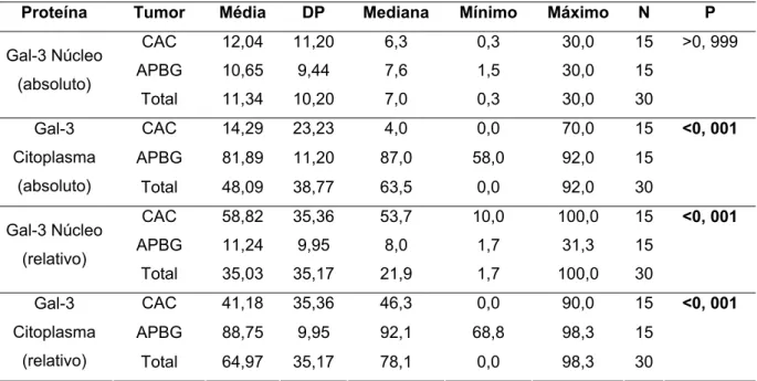 Tabela 5.3 –  Análise estatística da expressão da galectina-3 no carcinoma adenóide cístico e  no adenocarcinoma polimorfo de baixo grau de malignidade 