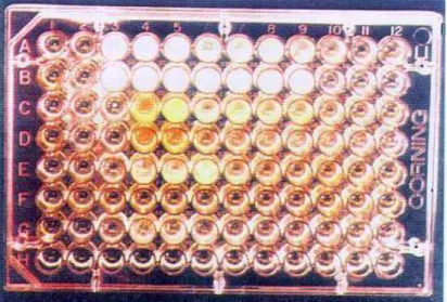 Figura 7 –  Microplaca, com 96 orifícios, após execução das  microdiluições em caldo RCM para o hidróxido de cálcio.
