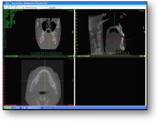 Figura 4.1 – Software i-CAT 3D Imaging System 