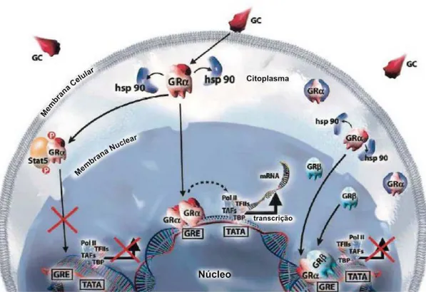 Figura 1 - Mecanismos de resistência ao corticóide (adaptado de Leung D et al 2003)