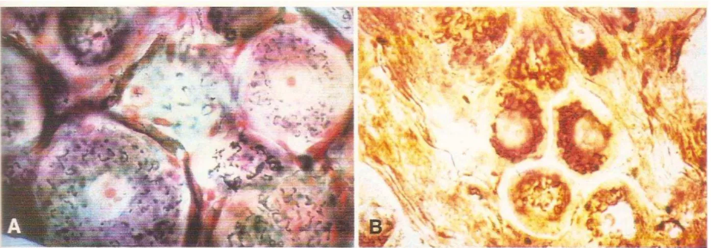 Figura 20: Preparações de Golgi. A: Células do gânglio espinhal. Autor desconhecido. Provavelmente  método fotográfico de Golgi