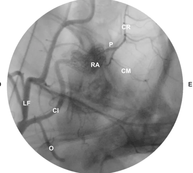 Figura 11 - Imagem angiográica em vista lateral do trajeto da artéria carótida interna  (CI), formação da rede admirável epidural rostral (RA), circulo arterioso  cerebral  (P),  artéria  cerebral  média  (CM),  artéria  cerebral  rostral  (CR),  visualiza