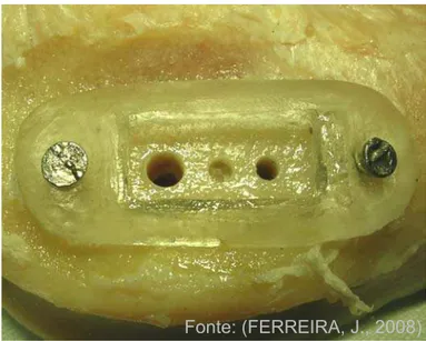 Figura 17- Vista superior da região epifisária distal do fêmur após as  perfurações de 3,0 X 9,0 mm, 2,0 X 3,5 mm e 2,0 X 11,0  mm 