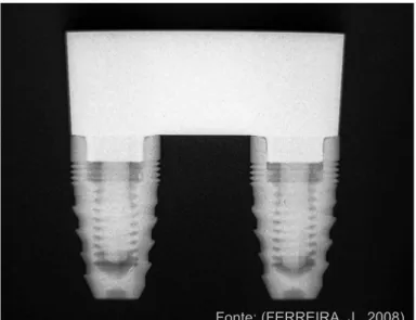 Figura 24- Imagem radiográfica do implante montado para obtenção  do padrão radiográfico antes da implantação 
