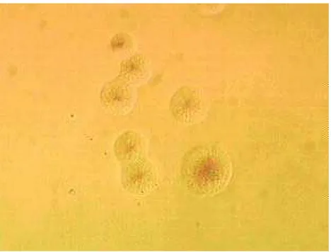 Figura 1- Colônias de Mycoplasma pulmonis em meio SP4, isoladas  de amostra de lavado traqueal de ratos