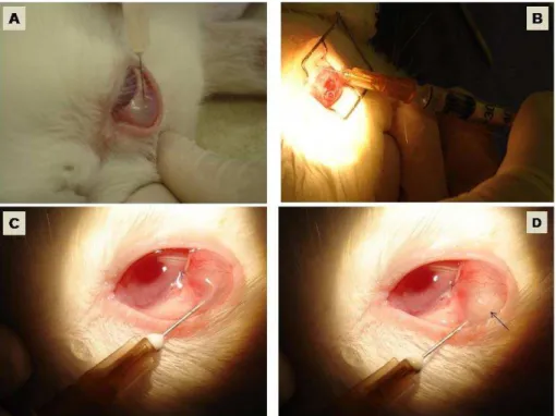 Figura 10: Fotos (A) e (B) representativas do grupo A. Injeção subconjuntival aplicada  três  dias  antes  da  cirurgia  (A)  e  ao  final  da  cirurgia  (B)