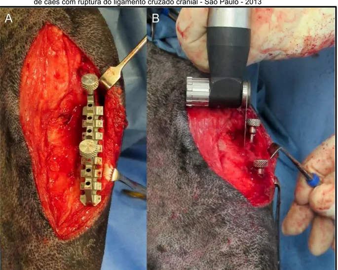 Figura 3 - Cirurgia de osteotomia de avanço da tuberosidade tibial (TTA) para estabilização do joelho  de cães com ruptura do ligamento cruzado cranial - São Paulo - 2013 