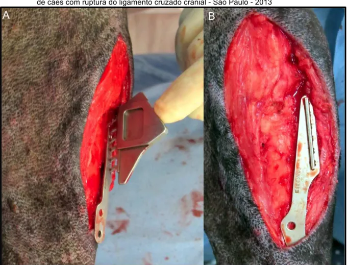 Figura 4 - Cirurgia de osteotomia de avanço da tuberosidade tibial (TTA) para estabilização do joelho  de cães com ruptura do ligamento cruzado cranial - São Paulo - 2013 