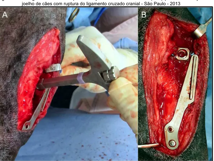 Figura  5  -  Cirurgia  de  osteotomia  para  avanço  da  tuberosidade  tibial  (TTA)  para  estabilização  do  joelho de cães com ruptura do ligamento cruzado cranial - São Paulo - 2013 