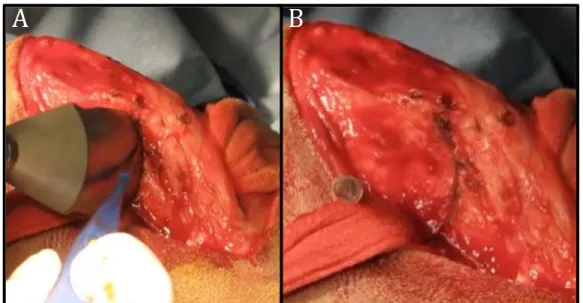 Figura  6  -  Osteotomia  para  nivelamento  do  platô  tibial  (TPLO)  para  estabilização  do  joelho  de  cães  com ruptura do ligamento cruzado cranial - São Paulo - 2013 