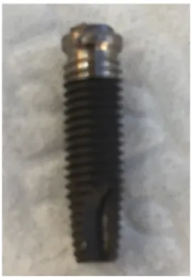 Figura 1: Implante  OSSEOTITE 4x13mm 