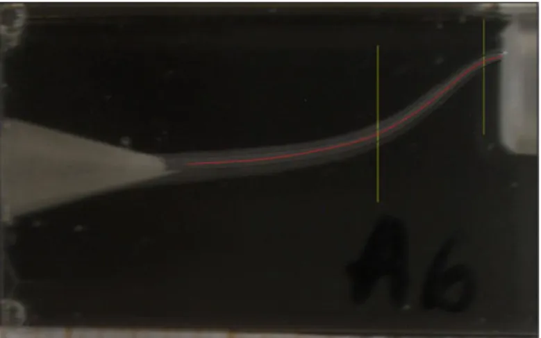 Figure 14 - Post instrumentation digital image  superimposed over the pre instrumentation.
