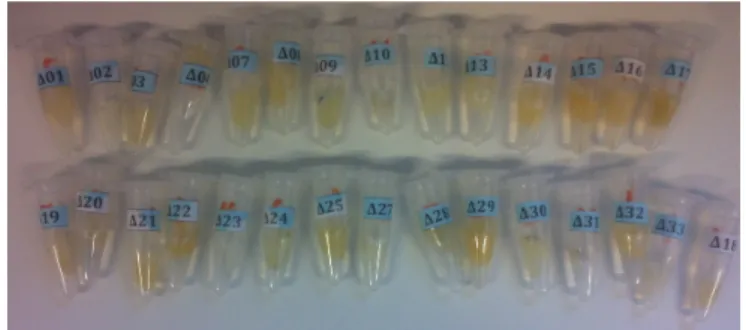 Figure 8  – Prepared teeth in Eppendorf ®  micro test tube 