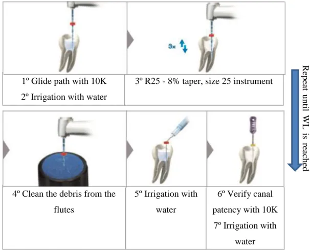 Figure 10 – Sequence of instrumentation with Reciproc® blue file (Reciproc® blue. 