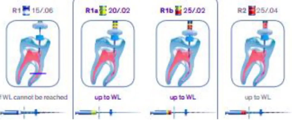 Figure 11 – Sequence of instrumentation with iRace/iRace Plus system (FKG, iRace,  instructions for use) 