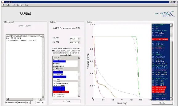 Figure 3.1 – Snapshot of the TARDIS software with the DVH sharpness.  