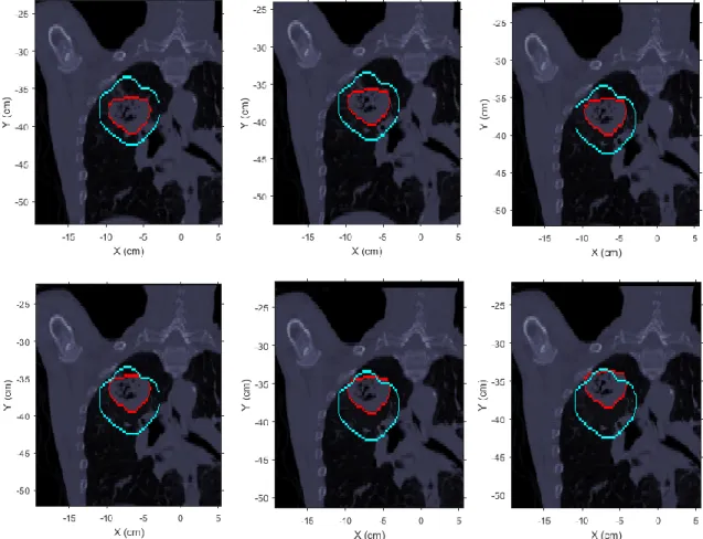 Figure 3.3 – Example of simulated tumor shifts of different magnitudes along the positive direction of Y axis