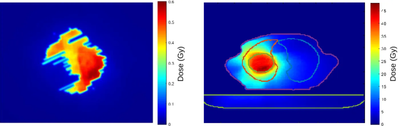 Figure 3.6 - Example of 2D and 3D dose distributions. Left: portal dose image at the EPID level
