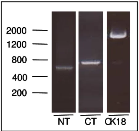 Figura 3 –  Amplificação de fragmentos de CK18 com sítios de restrição NdeI e XhoI,  a partir de cDNA (plasmídeo LK442-K18)