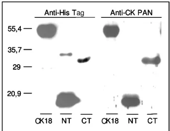Figura 6 –  Caracterização de CK18 e de seus fragmentos amino-(NTCK18) e carboxi- carboxi-terminais (CTCK18) frente à reatividade com anticorpos