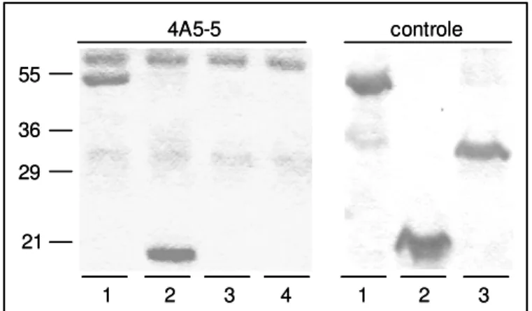 Figura 8 –  Anticorpo monoclonal contra peptídeo PD (4A5-5) imunoprecipita CK18 e  sua porção amino-terminal