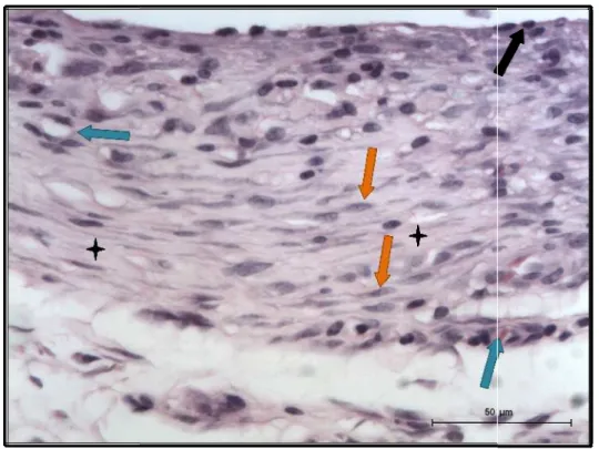 Figura 23- MTA Bio Ângel