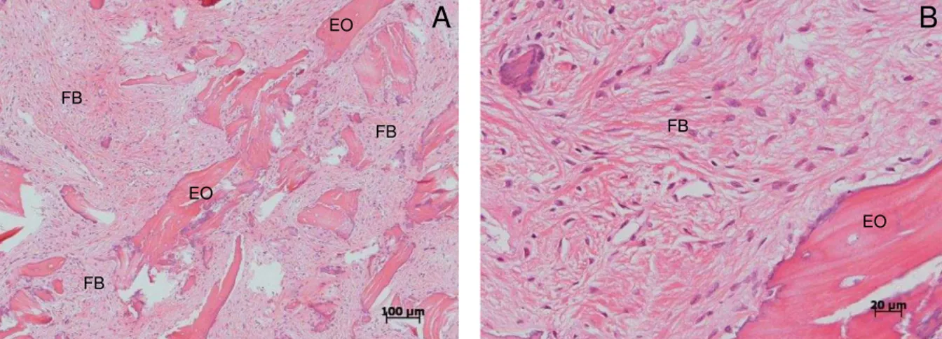 Figura 7. Característica microscópica das amostras de tecido obtidas dos sítios submetidos a  enxerto de FFBA