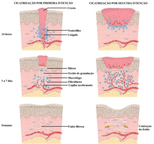 Figura 2 - Reparo tecidual por regeneração e por fibrose. 