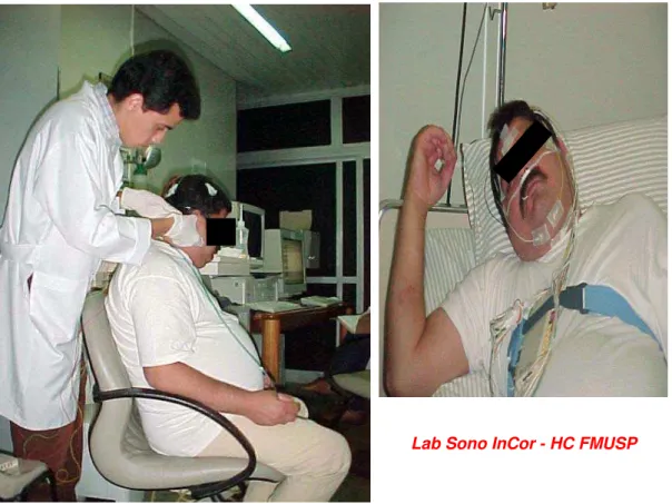Figura 1. Montagem dos acessórios no paciente e realização do exame de  polissonografia