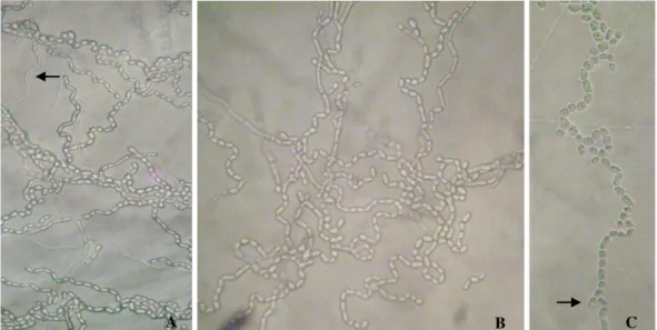 Figura 4.   Aspectos  micromorfológicos  de  isolados  de  Trichosporon  spp.  –   Aumento  400x