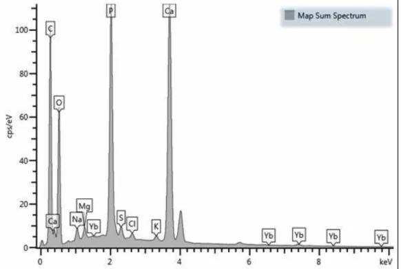 Figura 5: Exemplo dos picos vindo de uma amostra controle, relatório do aparelho  da Oxford Instruments do softwar Aztec