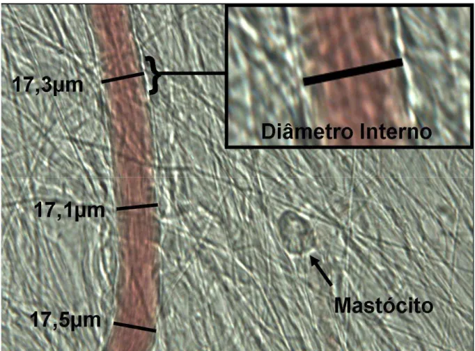 Figura  4  –  Vênula  pós-capilar  do  leito  mesentérico  de  rato,  superfundido  com  solução  nutriente  (Ringer  Locke)  e  observado  em  microscopia  intravital