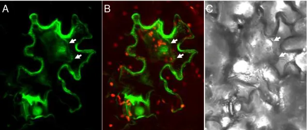 Figura 7 - Localização subcelular de CML38 fusionada a GFP em célula da epiderme de Nicotiana tabacum