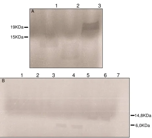 Figura 10 - Síntese e processamento in vitro de AtRALF1 marcado. Eletroforese (SDS-PAGE) de amostras das proteínas sintetizadas com o Kit de transcrição e tradução TNT Coupled Wheat Germ Extract (Promega)