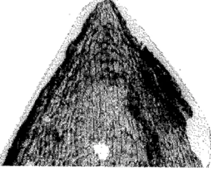 Fig.  l4  -  Sinopse  dos vorioções cuficulores  do  foce inferior  de