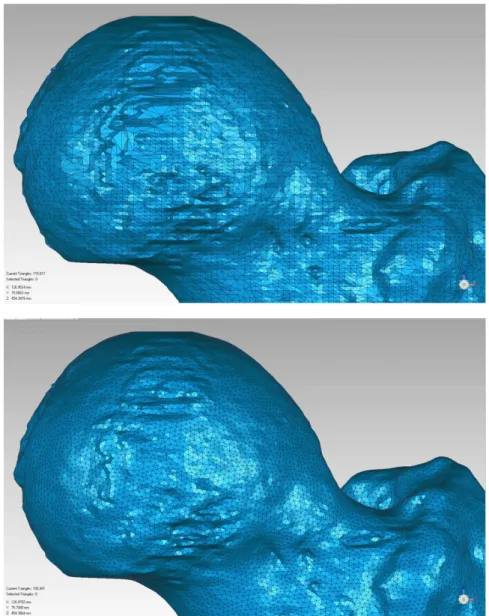 Figure 5.3. The mesh over the Femur head before (Above) and after (Below) remeshing. The number of elements was raised  from 115 817 to 199 461, with the triangle edge length changing from 1.256 mm to 0.905 mm on the Femur model