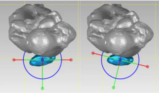 Figure 5.4. Patella model before (Left) and after (Right) reorientation. 
