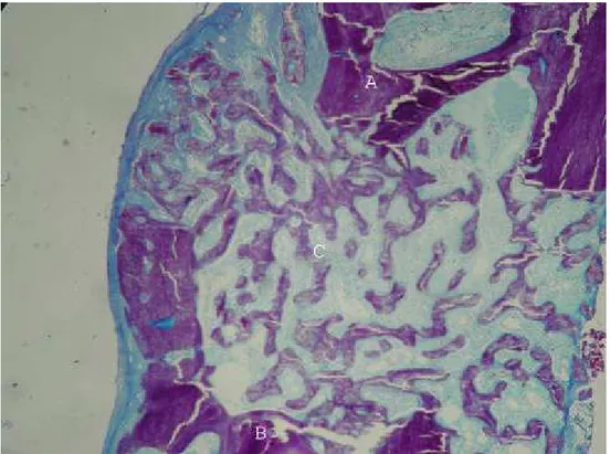 Figura 17 – Corte histológico de coelho do grupo de duas semanas (10X)          A – Osso do coelho receptor 