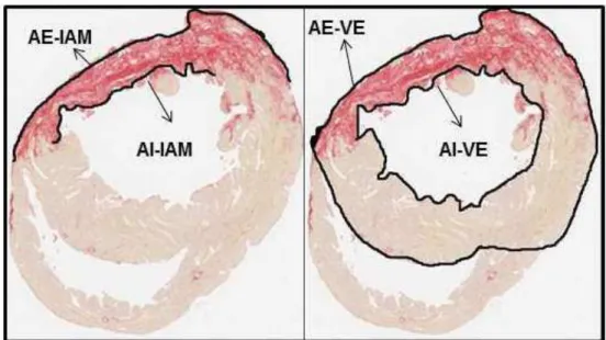 Figura 8 -  Medida da área de infarto: AE-IAM (área externa do infarto), AI-IAM (área  interna  do  infarto),  AE-VE  (área  externa  do  ventrículo  esquerdo),  AI-VE  (área interna do ventrículo esquerdo)