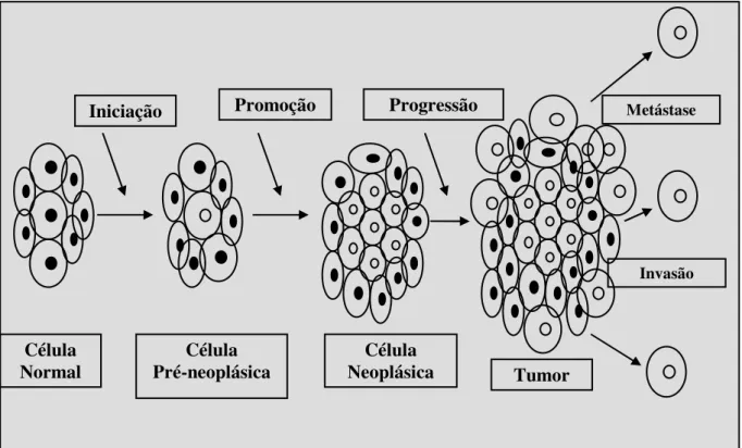Figura 1: Etapas da carcinogênese – iniciação, promoção, progressão e metástase. 